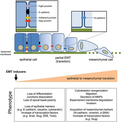 Targeting the Metabolic Reprogramming That Controls Epithelial-to-Mesenchymal Transition in Aggressive Tumors